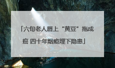 六旬老人唇上“黄豆”拖成癌 四十年烟瘾埋下隐患